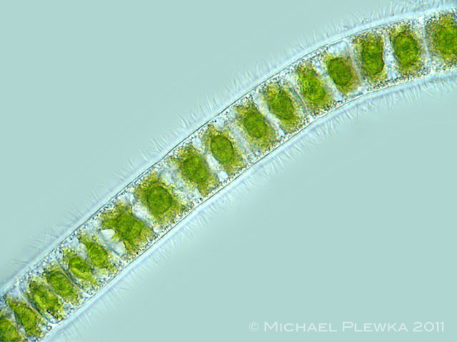 Leben in Teich und Garten Sternalge (Zygnema sp.) Zieralgen Conjugatophyta